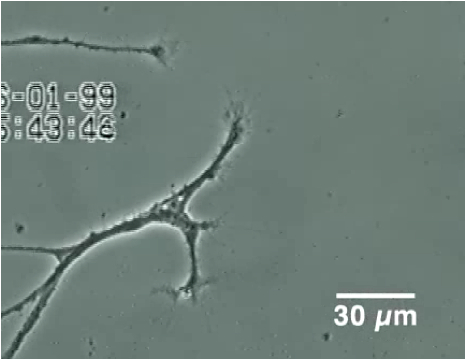 toxbrain neuron3.jpg