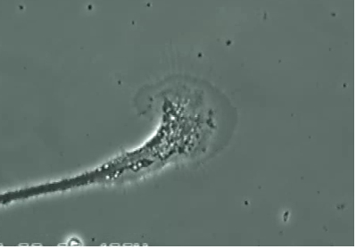 toxic brain neuron1.jpg